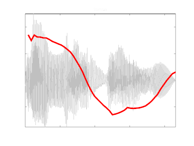 Turkish intonation