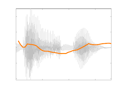 Venetian intonation